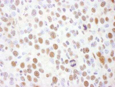 Immunohistochemistry: Rad17 [p Ser645] Antibody [NB100-273]